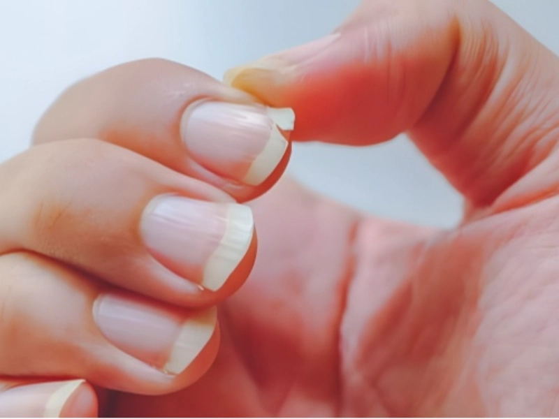 What Your Nails Secretly Reveal About Your Health