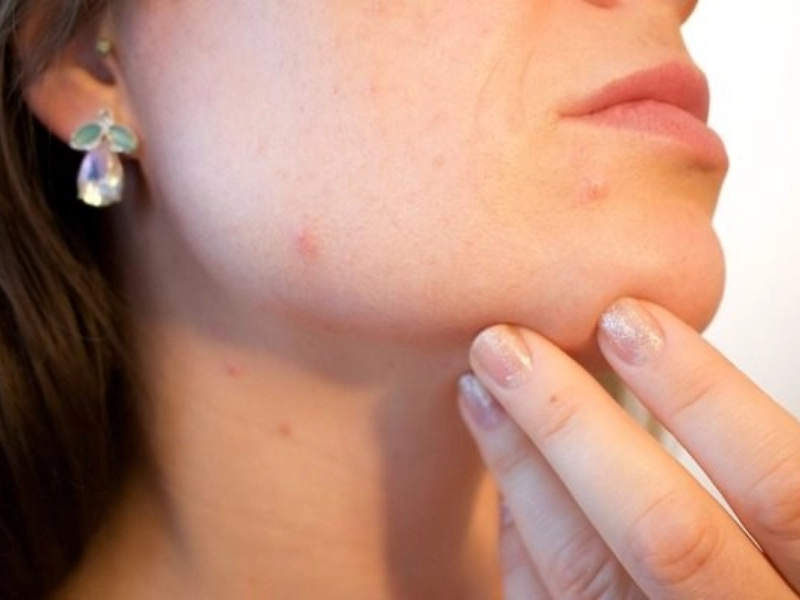 7 Incredible Baking Soda Benefits For Hair, Skin & Body